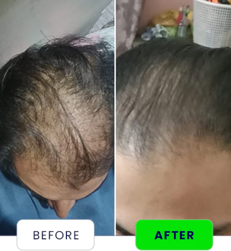 Anagrow Rosemary Hair Oil